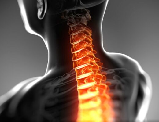 cervical-herniated-disc-symptoms-treatment-and-exercises