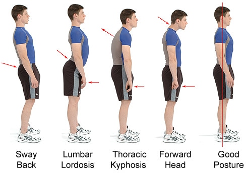 The importance of good posture for back pain
