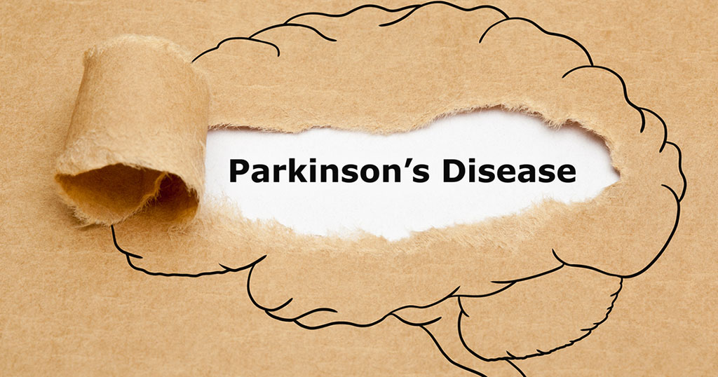 Parkinson’s-Disease