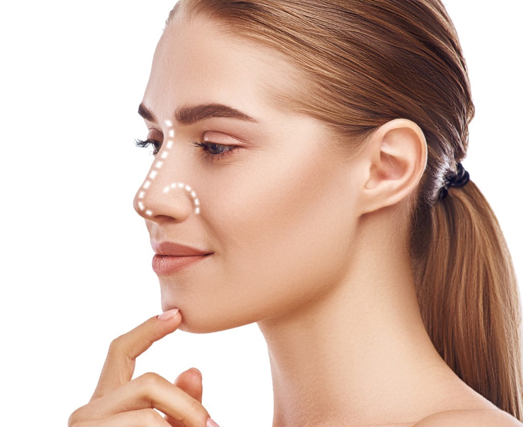 rhinoplasty-nose