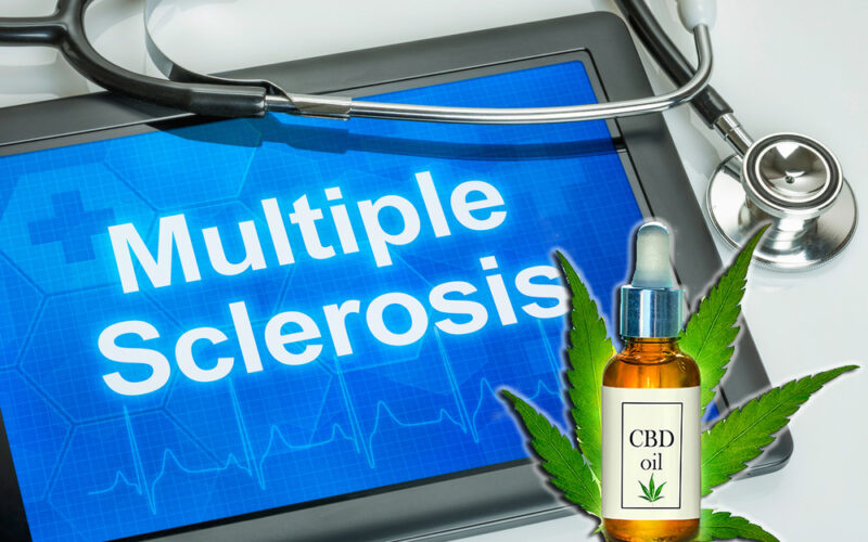 Best CBD Oil for Multiple Sclerosis / MS (2021 Update)